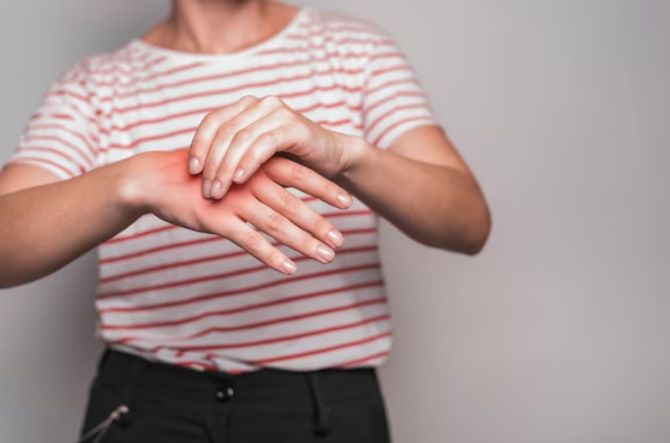 Arthritis------12